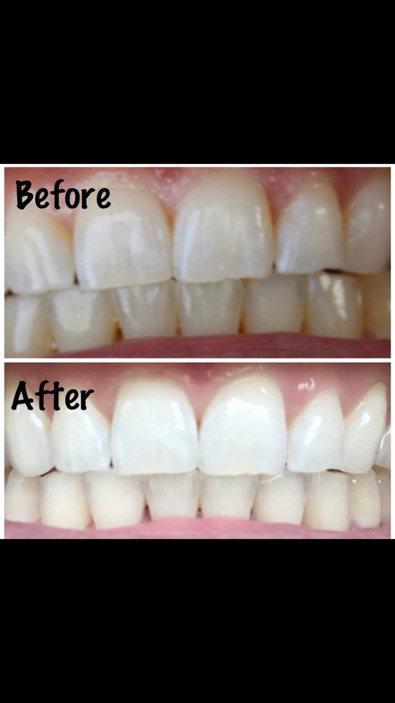 AP24 WHITENING TOOTHPASTE