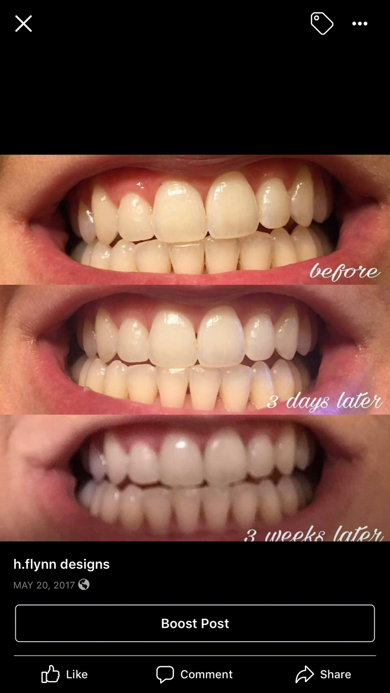 AP24 WHITENING TOOTHPASTE